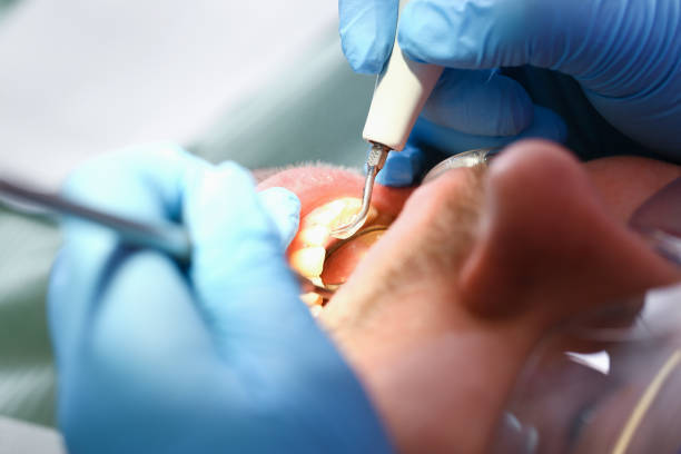 Best Broken or Chipped Tooth Repair in Llington, MI