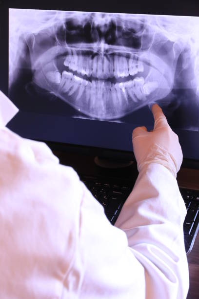 Best Emergency Dental Care for Sports Injuries in Llington, MI
