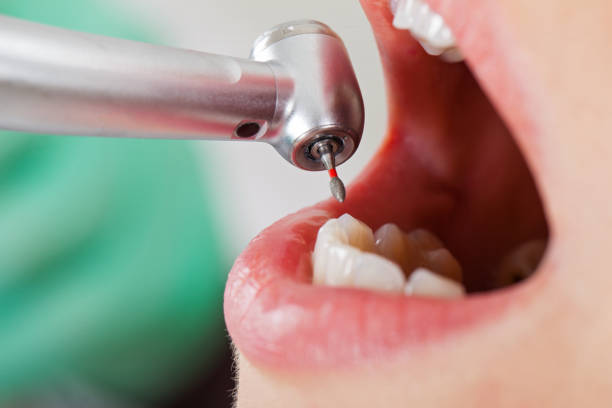 Best Emergency Dental Care for Sports Injuries in Llington, MI